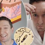 Demodex mites are living, mating on your face - what you need to know