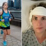 The NYC marathon runner recently had major brain surgery